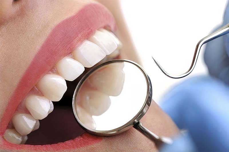 Primer plano de una exploración dental con espejo clínico y sonda.